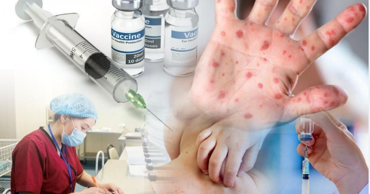 В Мангистауской области зафиксирован рост заболеваемости корью среди детей